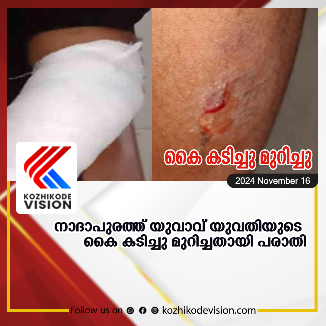 നാദാപുരത്ത് യുവാവ് യുവതിയുടെ കൈ കടിച്ചു മുറിച്ചതായി പരാതി